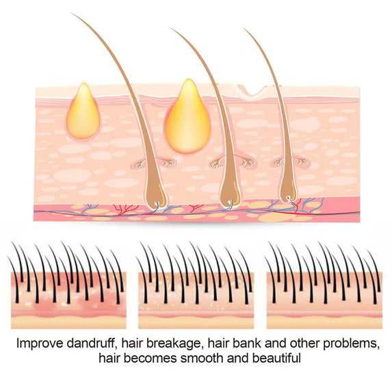 50g Sulfur Shampoo Remove Lice Mites Dandruff Itching Oil Cleaning Scalp Deep Hair Antipruritic Follicles Cleaning Hair Care