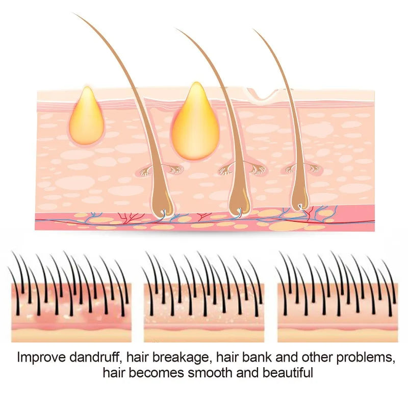 50g Sulfur Shampoo Remove Lice Mites Dandruff Itching Oil Cleaning Scalp Deep Hair Antipruritic Follicles Cleaning Hair Care
