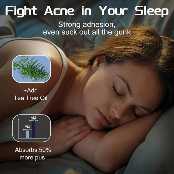 New Acne Patch Repair Facial Deep Cleansing Bear Invisible Pimple Removal Anti-Acne Patches Spots Marks Concealer Beauty