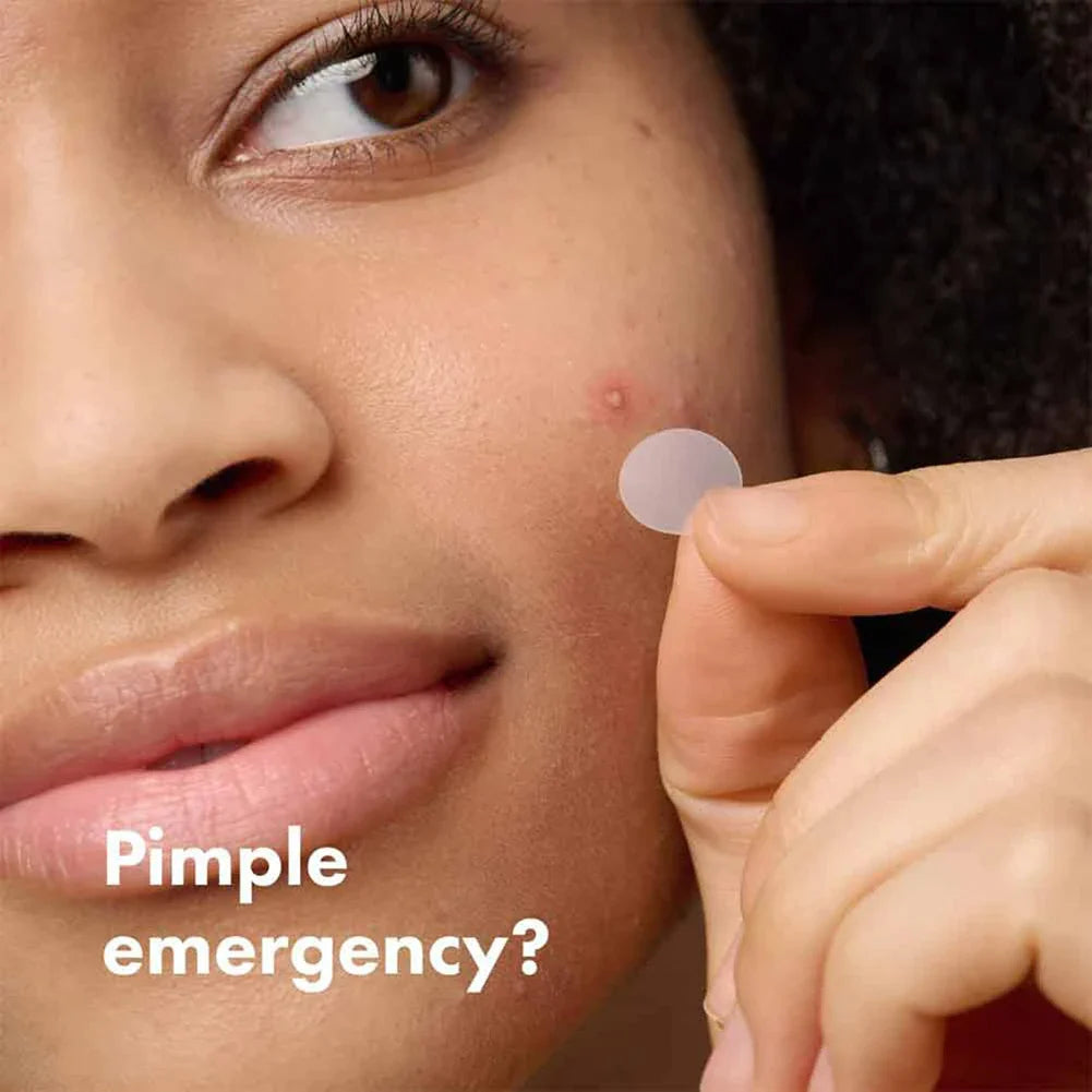Hydrogel Acne Patch Invisible Closed Mouth Invisible Acne Face Invisible Waterproof and Breathable Skin Patch Skin Care Tools