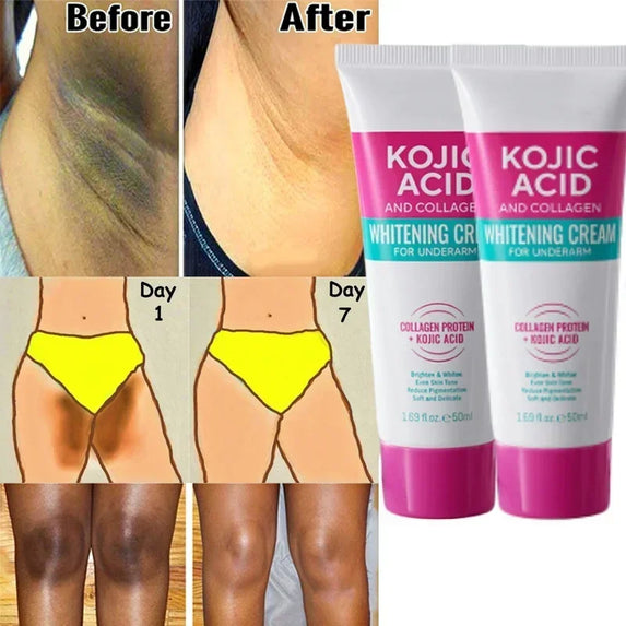 Collagen Underarm Cream Lightening Melanin Moisturizing Kojic Acid Cream Fade Dull Hand Body Elbows Fast Smooth Nourish Lotion