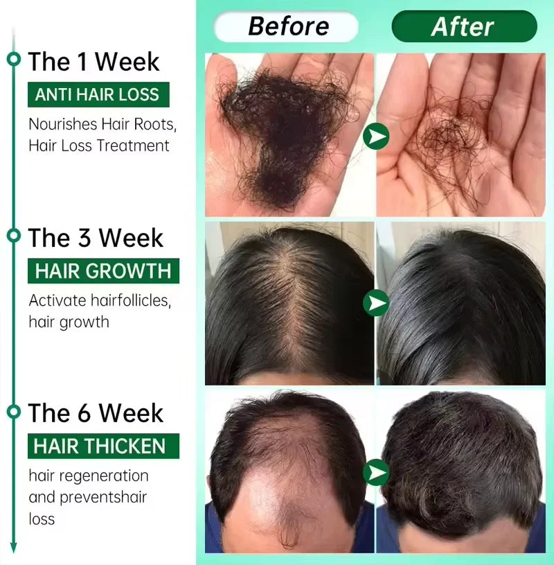 Rosemary Hair Growth Oil Anti Hairs Loss Treatment Mint Hair Strengthening Oil Nourishing Roots Regrowth Hair For Men Women 50ml