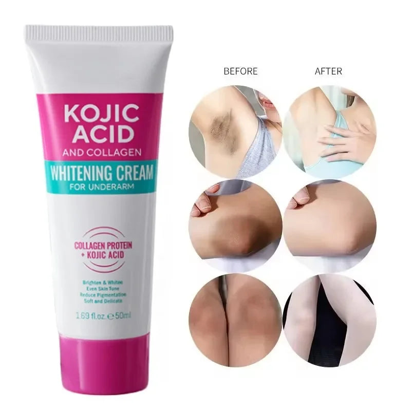 Collagen Underarm Cream Lightening Melanin Moisturizing Kojic Acid Cream Fade Dull Hand Body Elbows Fast Smooth Nourish Lotion