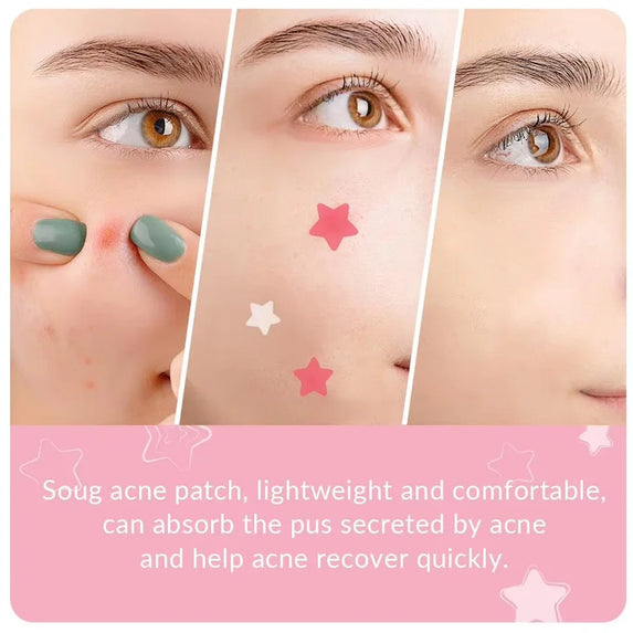 40/200Pcs Repair Acne Patch Fade Blemishes Pimple Marks Closed Acne Blemishes Hydrocolloid Star Shaped Cover Acne Pimple Patch