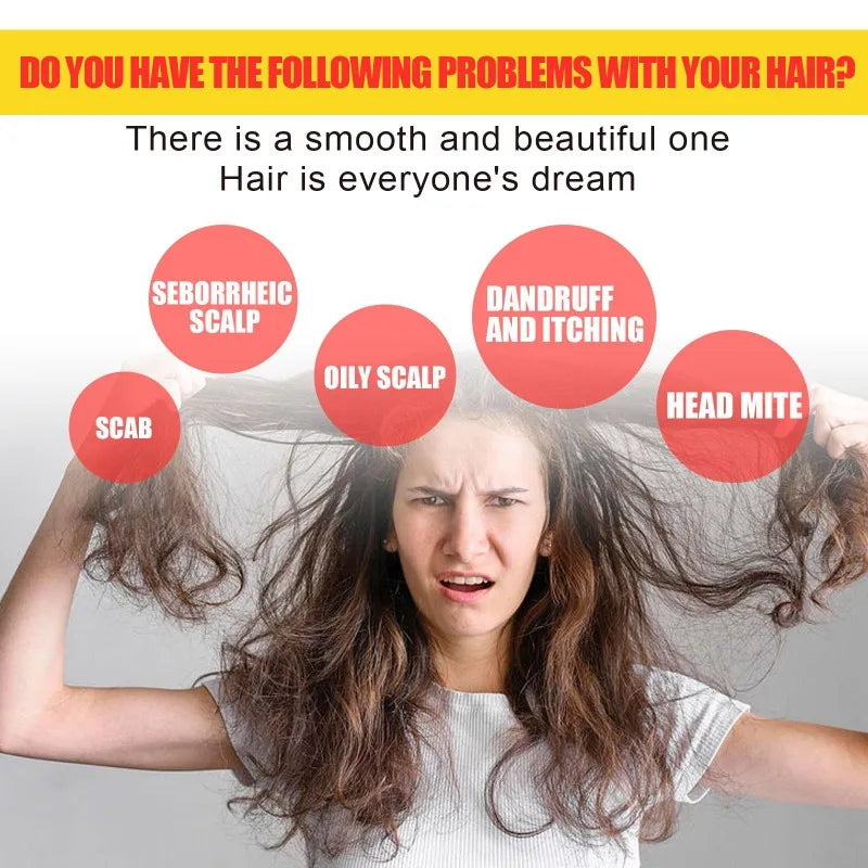 50g Sulfur Shampoo Remove Lice Mites Dandruff Itching Oil Cleaning Scalp Deep Hair Antipruritic Follicles Cleaning Hair Care