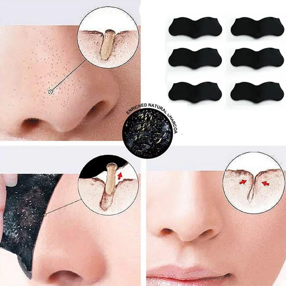 10 Pcs Bamboo Charcoal Blackhead Removal Nasal Patch Remove Acne Peel-off Nasal Strips Nose Spot Sticker Face Pore Cleaner Mask