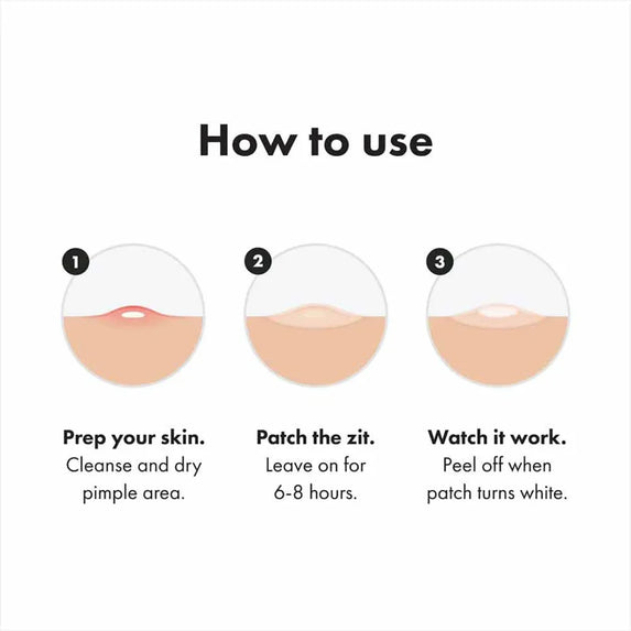 Hydrogel Acne Patch Invisible Closed Mouth Invisible Acne Face Invisible Waterproof and Breathable Skin Patch Skin Care Tools