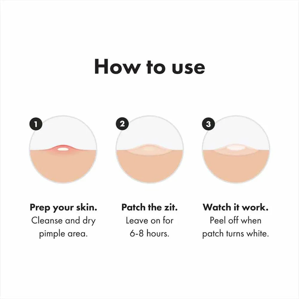 Hydrogel Acne Patch Invisible Closed Mouth Invisible Acne Face Invisible Waterproof and Breathable Skin Patch Skin Care Tools