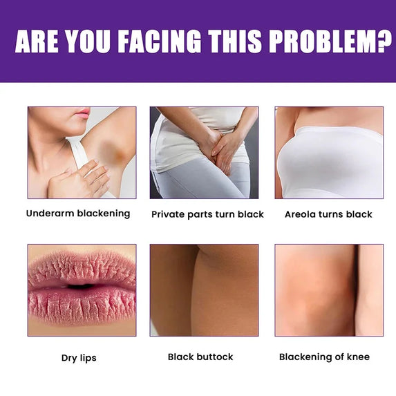 Whitening Cream Private Parts Underarm Bleaching Whiten Butt Knee Brighten Inner Thigh Intimate Parts Dark Remove Melanin Care