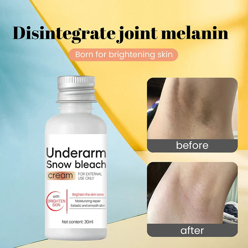 Whitening Cream Private Parts Underarm Bleaching Serum Whiten Butt Knee Brighten Inner Thigh Intimate Parts Dark Remove Melanin