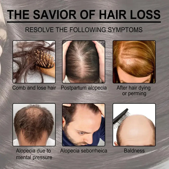 Rosemary Essentiall Oil Hair Growth Products Organic  Products Scalp Hair Strengthening Oil For Nourish Shiny  Healthy