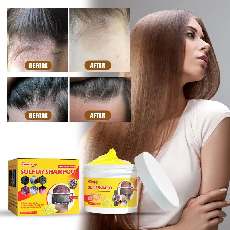 50g Sulfur Shampoo Remove Lice Mites Dandruff Itching Oil Cleaning Scalp Deep Hair Antipruritic Follicles Cleaning Hair Care