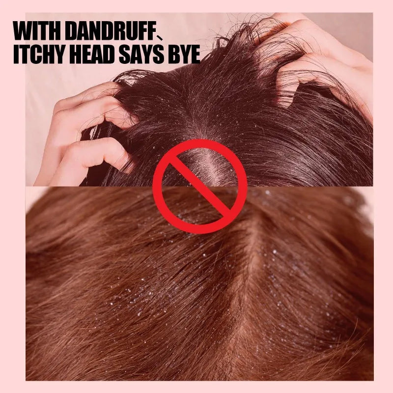 50g Sulfur Shampoo Remove Lice Mites Dandruff Itching Oil Cleaning Scalp Deep Hair Antipruritic Follicles Cleaning Hair Care