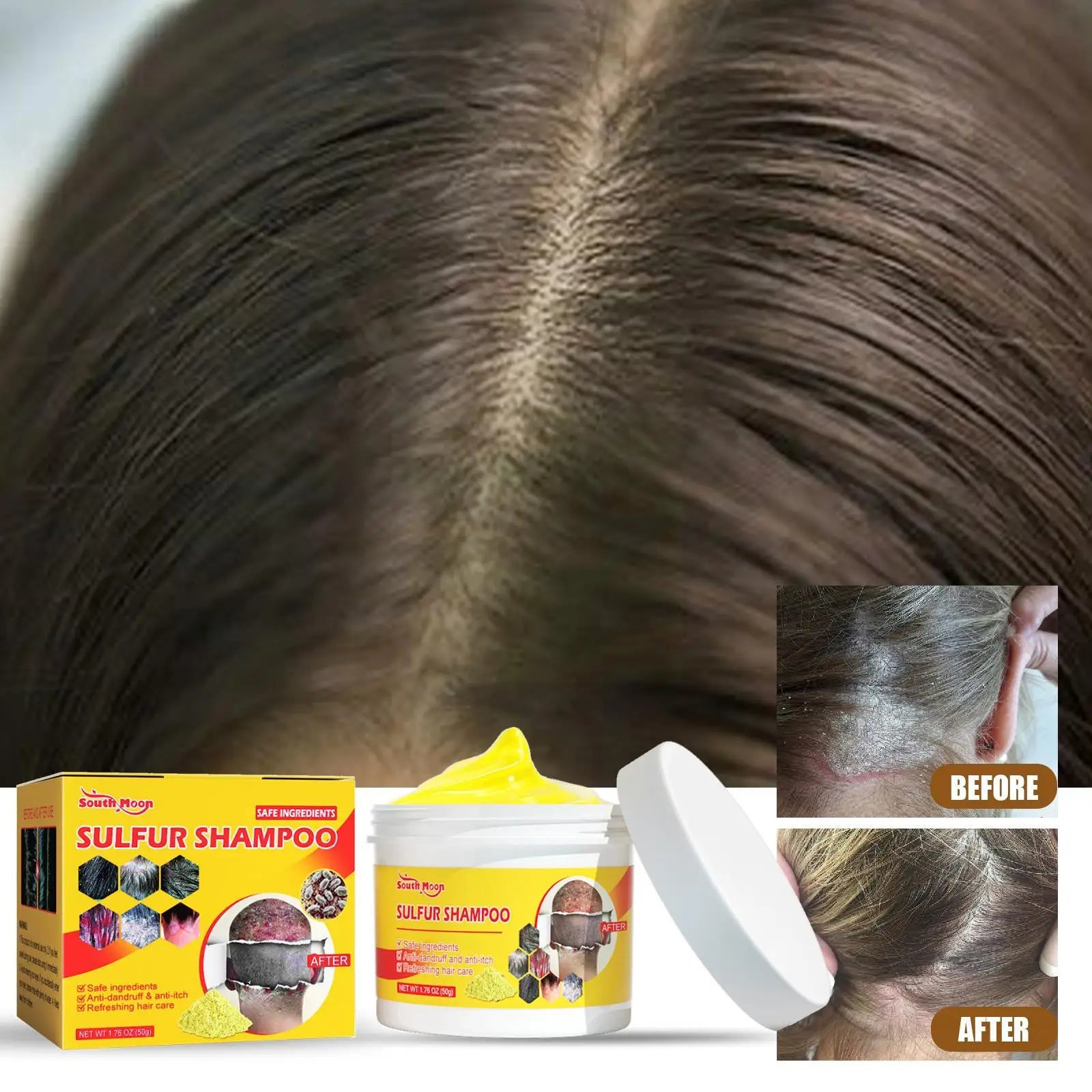50g Sulfur Shampoo Remove Lice Mites Dandruff Itching Oil Cleaning Scalp Deep Hair Antipruritic Follicles Cleaning Hair Care