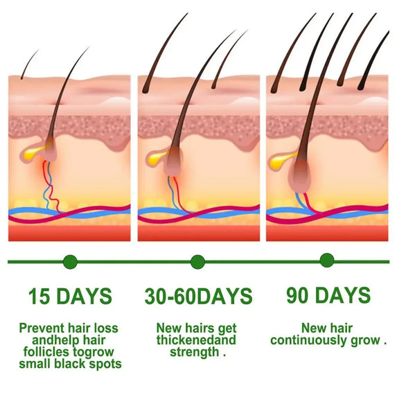 Rosemary Essentiall Oil Hair Growth Products Organic  Products Scalp Hair Strengthening Oil For Nourish Shiny  Healthy