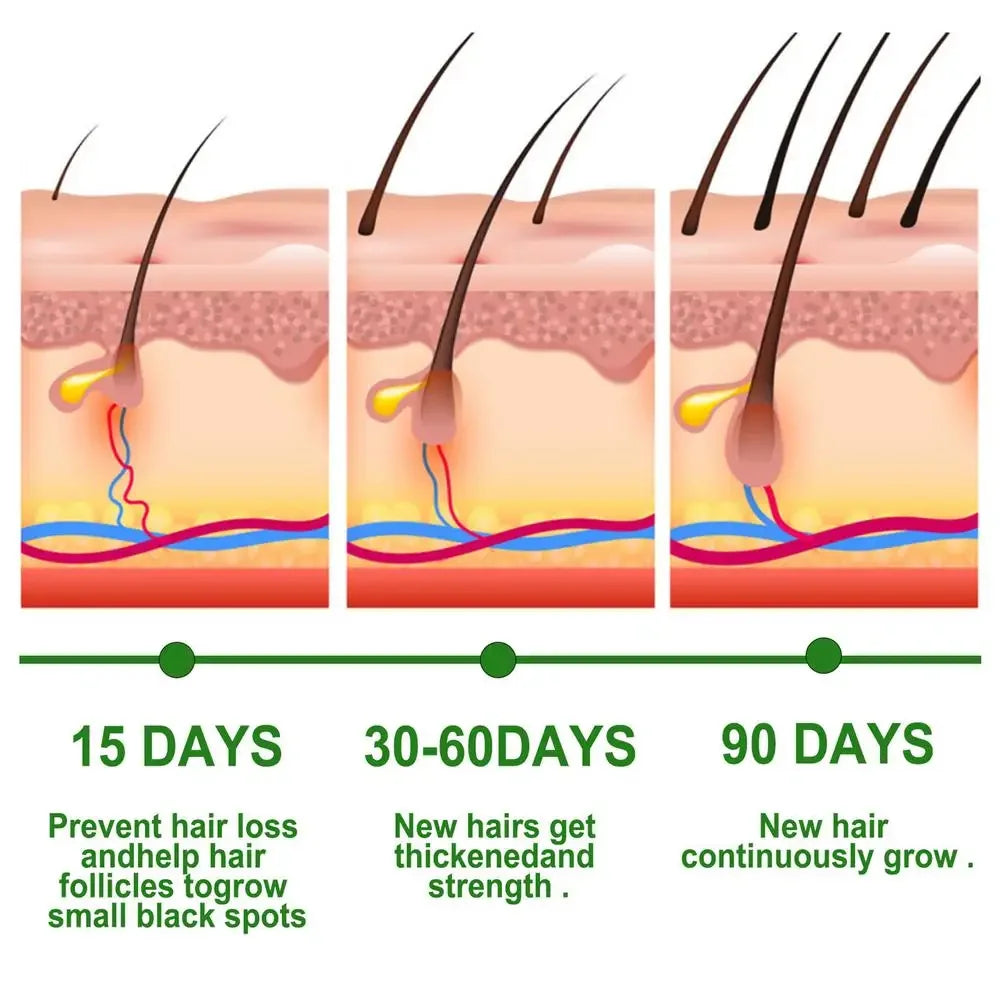 Rosemary Essentiall Oil Hair Growth Products Organic  Products Scalp Hair Strengthening Oil For Nourish Shiny  Healthy