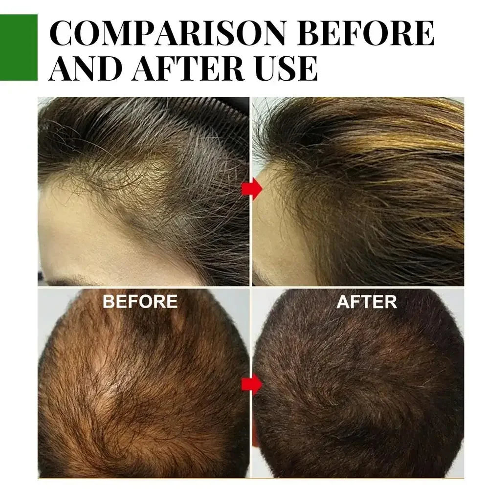 Rosemary Essentiall Oil Hair Growth Products Organic  Products Scalp Hair Strengthening Oil For Nourish Shiny  Healthy