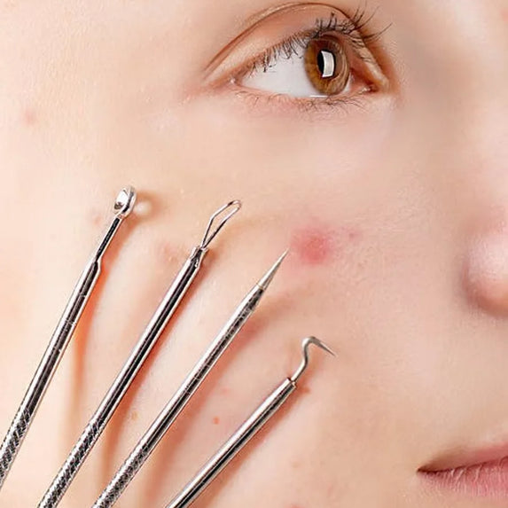 Blackhead Acne Remover 4pcs Comedone Black Head Blemish Pimple Removal Needle Face Skin Beauty Care Cleansing Pore Cleanser